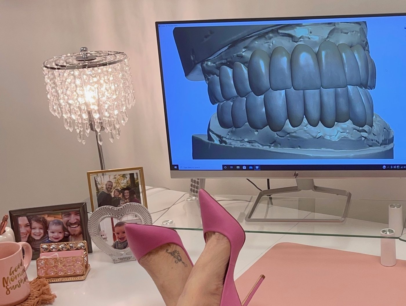 The She Designs studio: a full arch digital scan on the monitor at the bench