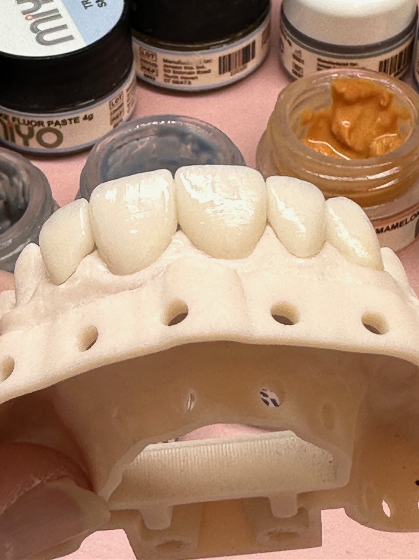 Anterior units on a model surrounded by open jars of ceramic stain, including a mamelon shade